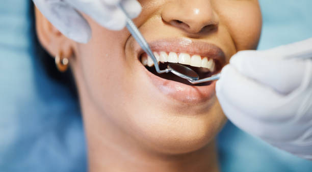 Best Emergency Dentist for Knocked-Out Tooth in Mount Plymouth, FL